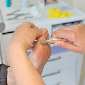 Professionelle Fußbehandlung
